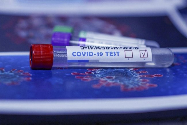 Rusiyada koronavirusa yoluxma halları artır