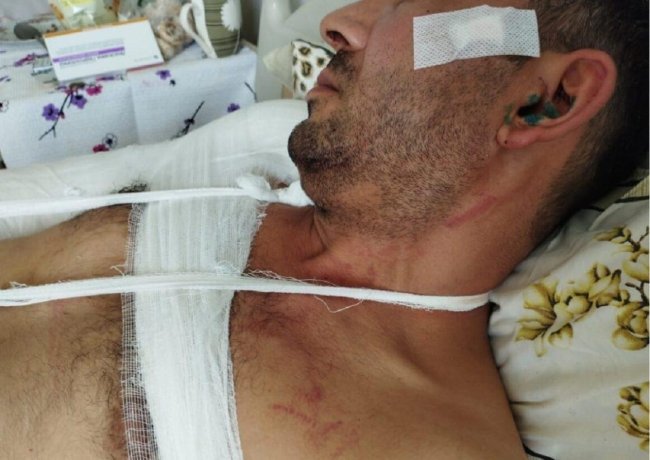 "İdarədə məni döydülər, ömürlük şikəst ediblər..." - İmişli sakini polisdə işgəncələrdən şikayətlənir+ FOTOLAR