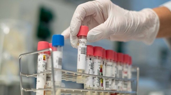Yeni Klinika” tibb müəssisəsində istifadə üçün nəzərdə tutulmuş laboratoriya testlərinə 10.6 milyon xərclənəcək