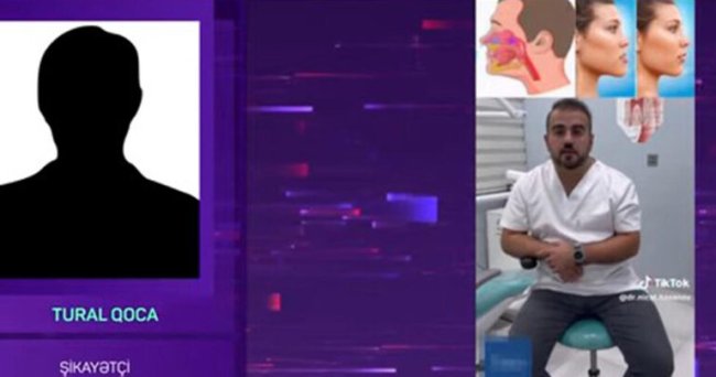 500 manat ziyana düşdü, az qaldı ölsün - “TikTok Stomatoloqu” barəsində AĞIR İDDİA - VİDEO