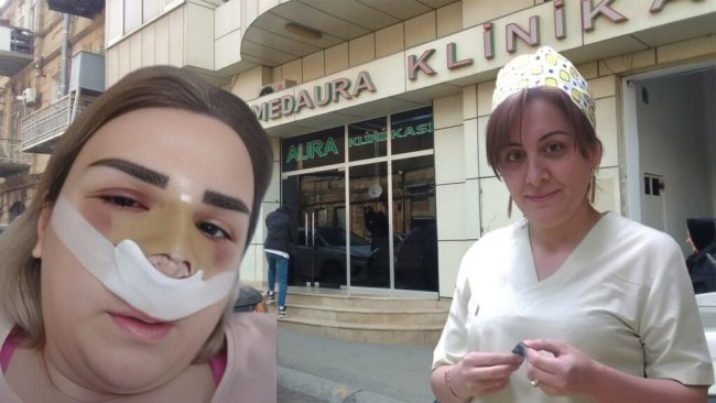 Ölüm saçan “MedAura” klinikası – Uğursuz əməliyyatlara səbəb olan Nigar Məhəmmədova iş başındadır? -DETALLAR