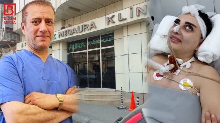 Gənc qızı komaya salan həkim İŞ BAŞINDA – FOTOFAKT