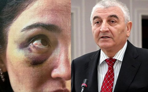 MSK sədrinin eks-gəlininə veriləcək 300 minlik əmlakın - Siyahısı